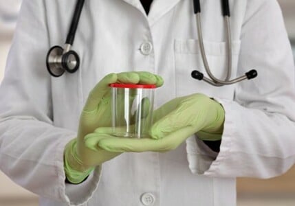 A lab technician holding an empty urine specimen jar.