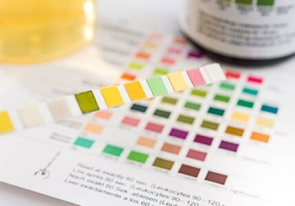 Matching the colors of a used drug test strip to a chart.